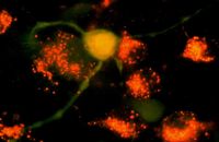 Aufsicht auf die Netzhaut einer Ratte: Nervenzelle mit eingeschleustem grünfluoreszierendem Gen einer Tiefseequalle (Aquorea Victoria). UKT, Dr. Perikles Simon