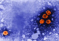 Hepatitis-B-Virionen im Elektronenmikroskop
Quelle: cdc/Erskine Palmer (idw)