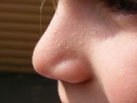 Nase: Auch Kinder passen Verhalten an Duft an. Bild: Widdertier/pixelio.de