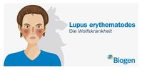 Lupus erythematodes Bild: Biogen GmbH Fotograf: Biogen GmbH