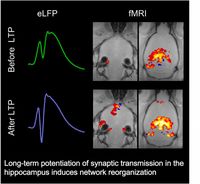 Die langfristige Verstärkung der Reizübertragung an den Synapsen (LTP) im Hippocampus führt zu einer weit reichenden Neuorganisation des Nervennetzes. Die Bilder des Kernspintomographen (fMRI) zeigen, welche Gehirnareale gerade stark durchblutet und damit aktiv sind. Bild: Santiago Canals / Max-Planck-Institut für biologische Kybernetik