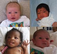 Neugeborene: Neue Tabellen bleiben umstritten. Bild: ox.ac.uk