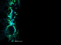 Einzelne Muskelzelle des Fadenwurms, die den Fluoreszenzsensor Redox-GFP im Endoplasmatischen Retiku
Quelle: Kirstein, FMP (idw)