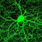 Die Synapsen dieser Nervenzelle hemmen den Informationsfluss anderer Zellen. Foto: MPI für Neurobiologie / Keck
