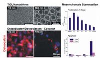 Einfluss von Oberflächengeometrien im Nanometerskalenbereich auf Mesenchymale Stammzellen Abbildung: Stefan Bauer