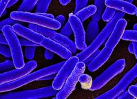 E. coli: Nicht alle Stämme machen krank. Bild: PRONIAID, flickr.com