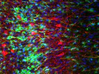 Hirngewebe, in dem Abwehrzellen (Mikrogliazellen) grün, ein bestimmter Typ von Nervenzellen rot und
Quelle: Universitätsklinikum Heidelberg (idw)