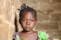 Die achtjährige Valentine aus Kamerun Bild: CBM Fotograf: Tobias Pflanz