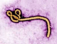 Ebola: Molekül-Computer erkennt Virus schnell. Bild: cdc.gov