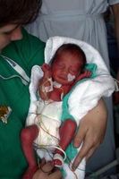 Baby nach der Geburt: verzögerte Abnabelung gut. Bild: N. Schmitz, pixelio.de