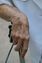 Frauenhand: Demenz im Alter keine Seltenheit. Bild: pixelio.de, angieconscious)