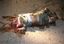 Eine Leiche, getötet durch eine Detonation mit Sprengstoff (Symbolbild)
