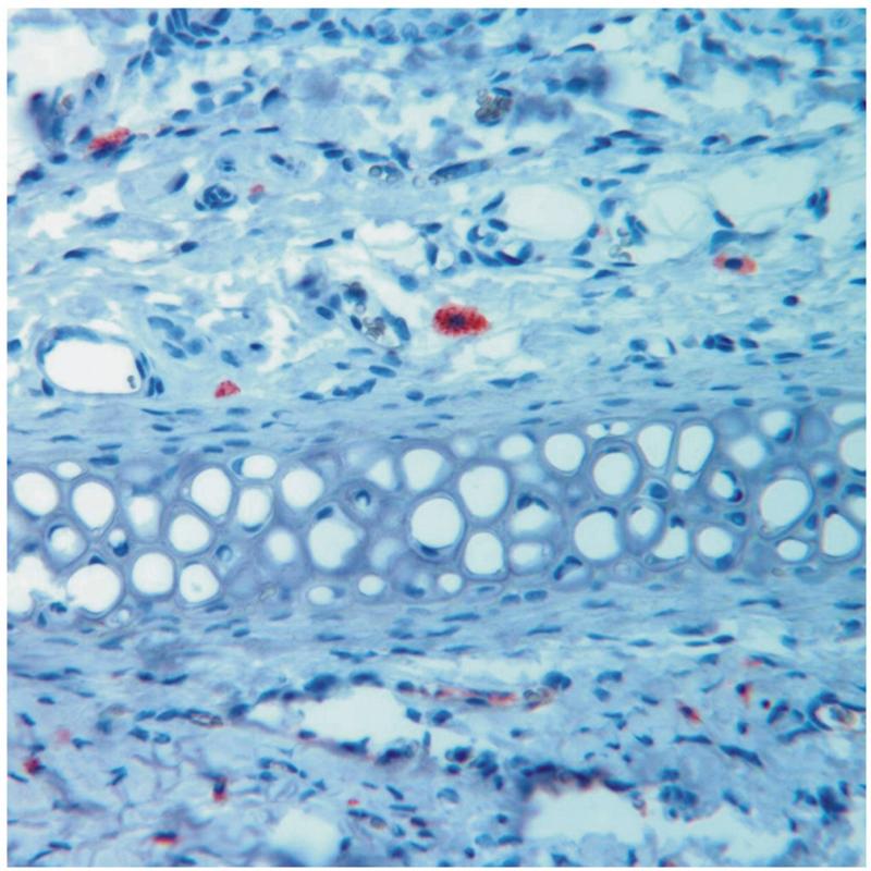 Fresszellen (Makrophagen, rot) im Bindegewebsraum der Haut. Abbildung: Nikolaus-Fiebiger-Zentrum für Molekulare Medizin