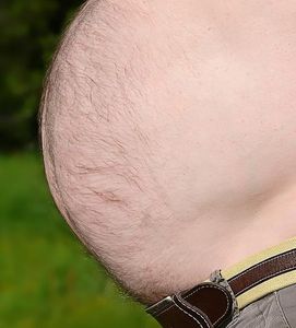Übergewicht: SRC-1-Gen beeinflusst Appetit.