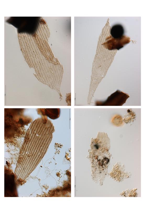 Beispiele für fossile Schmetterlings-Schuppen. Bild: Copyright Bas van de Schootbrugge (idw)