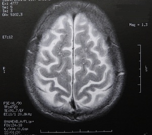 Das menschliche Gehirn verfügt über enorme "Rechenpower". Bild: pixelio.de/Dieter Schütz